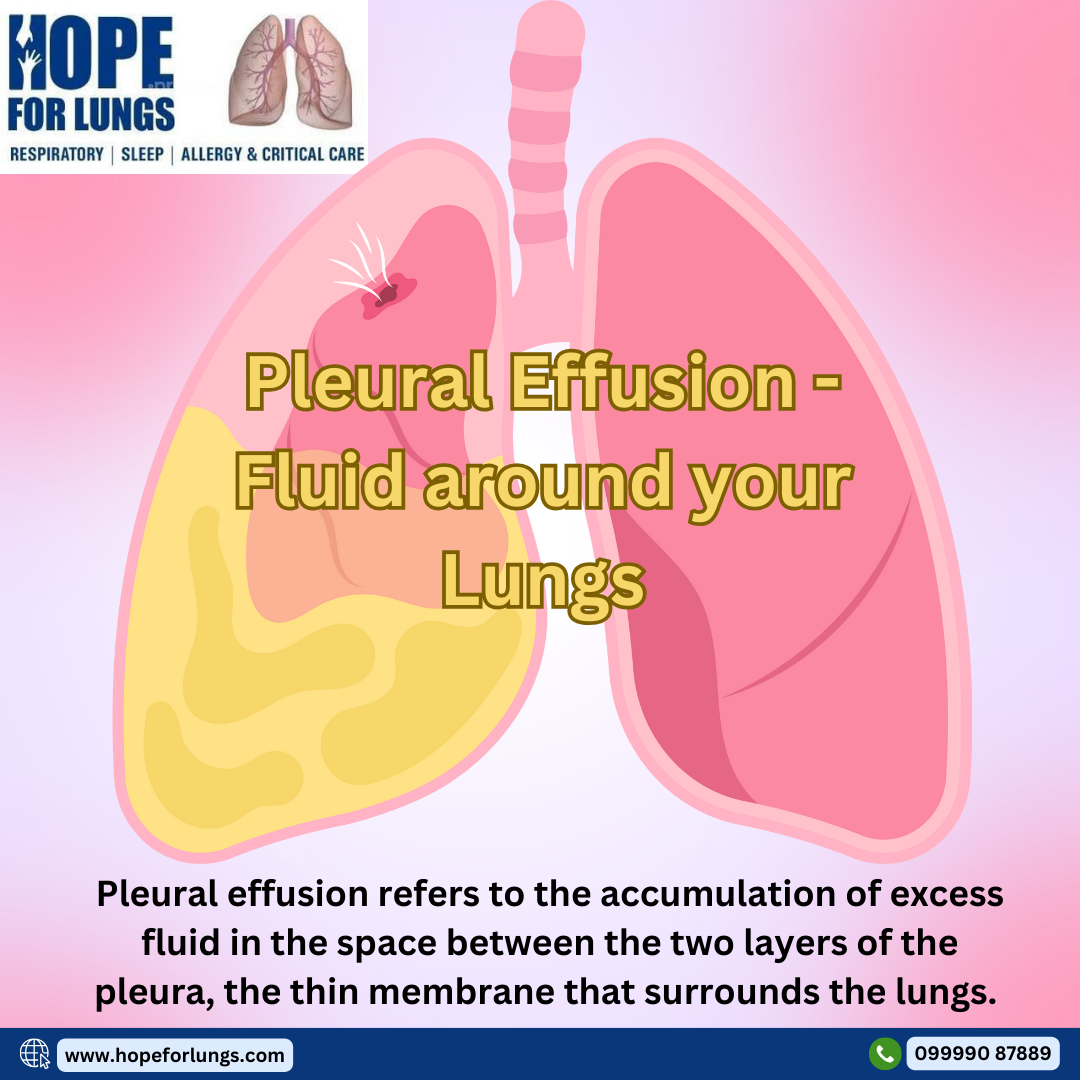 Pleural effusion Fluid around your lungs